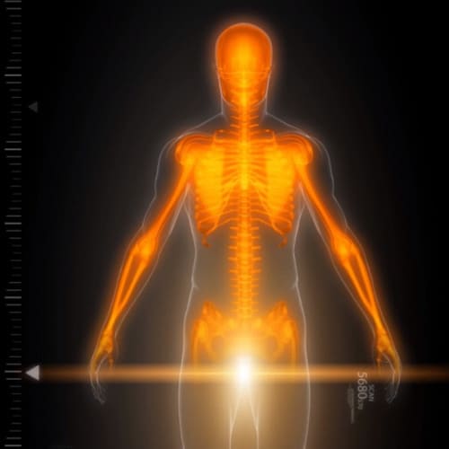 Bioimpedância – Tera Science: 