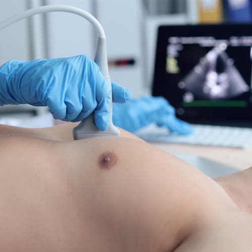 Ecocardiograma Transtorácico – EcoTT: