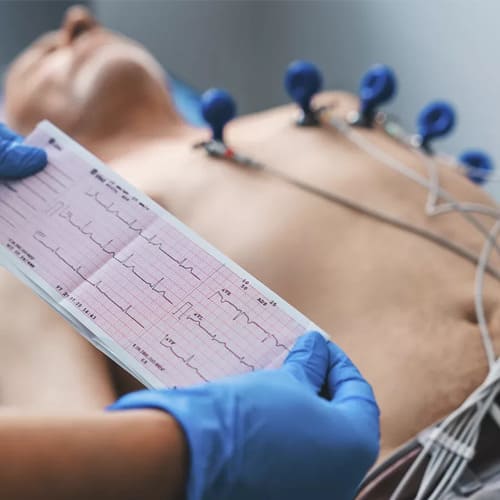 Eletrocardiograma – ECG: